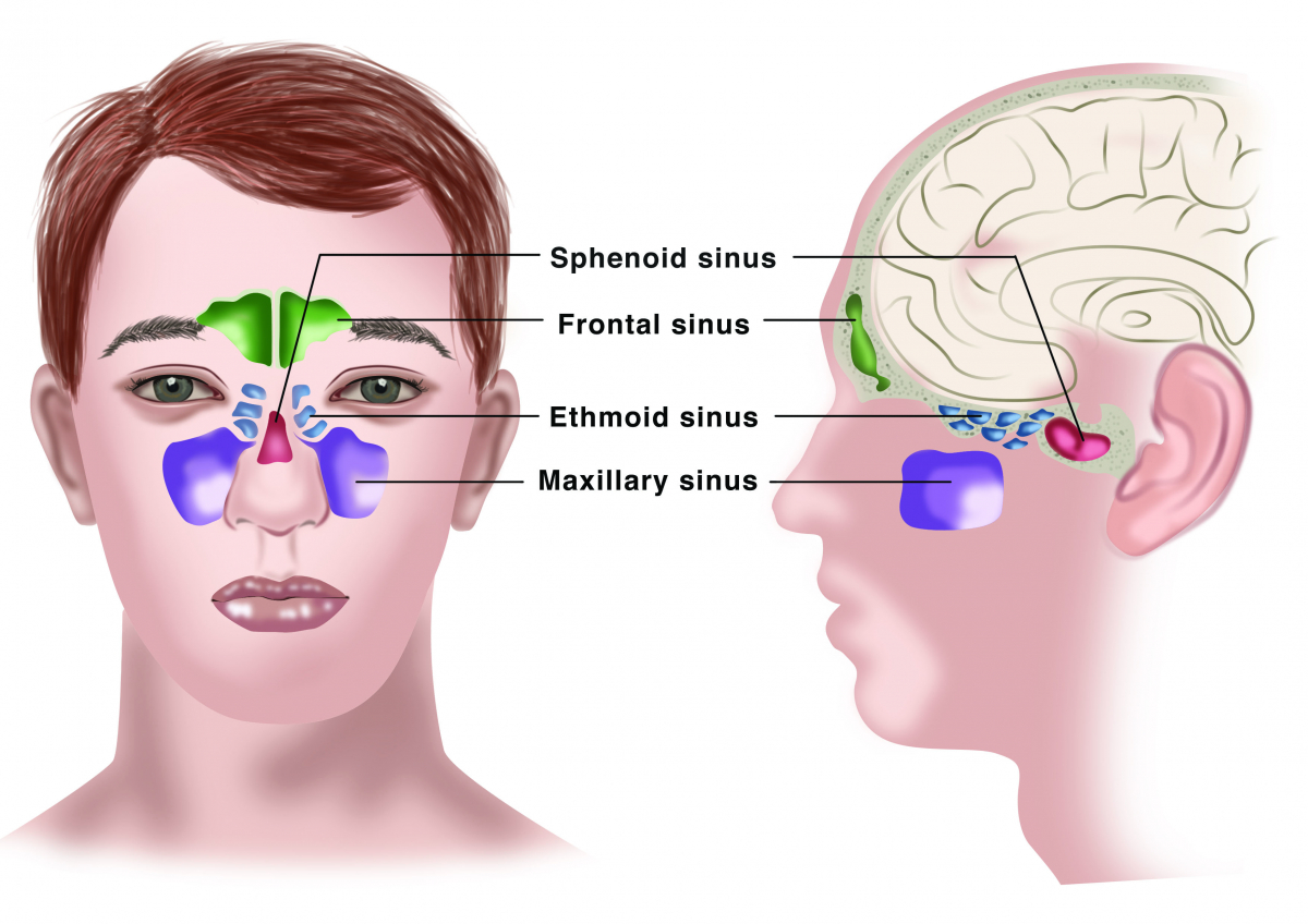 Sinusotomy four sinuses unilateral cpt code