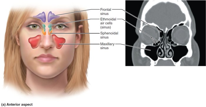 Sinuses anatomy diagram maxillary sinus head sinusitis maxilla surgery bone solstice winter 2010